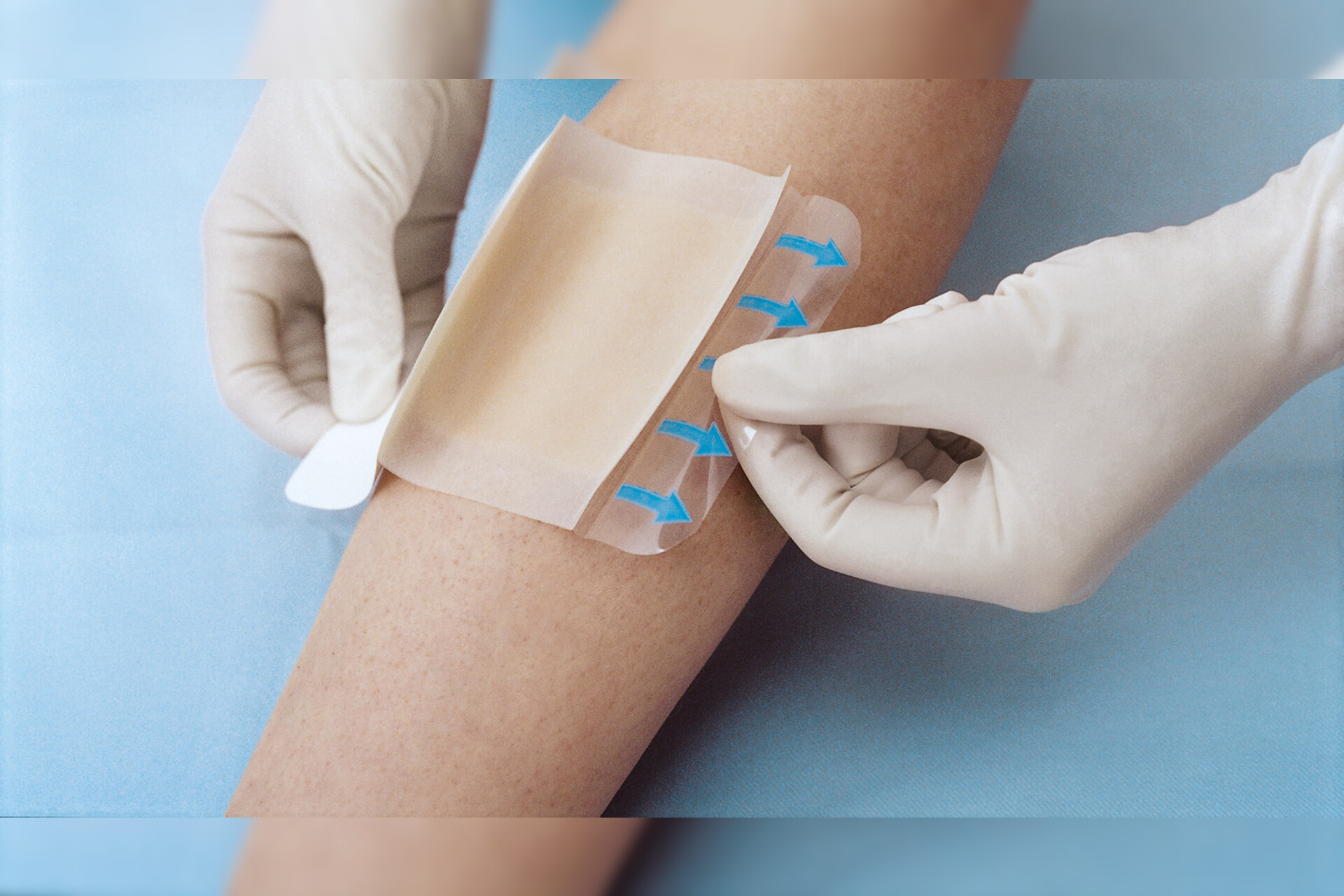 Hydrocoll Hydrokolloid - Verband