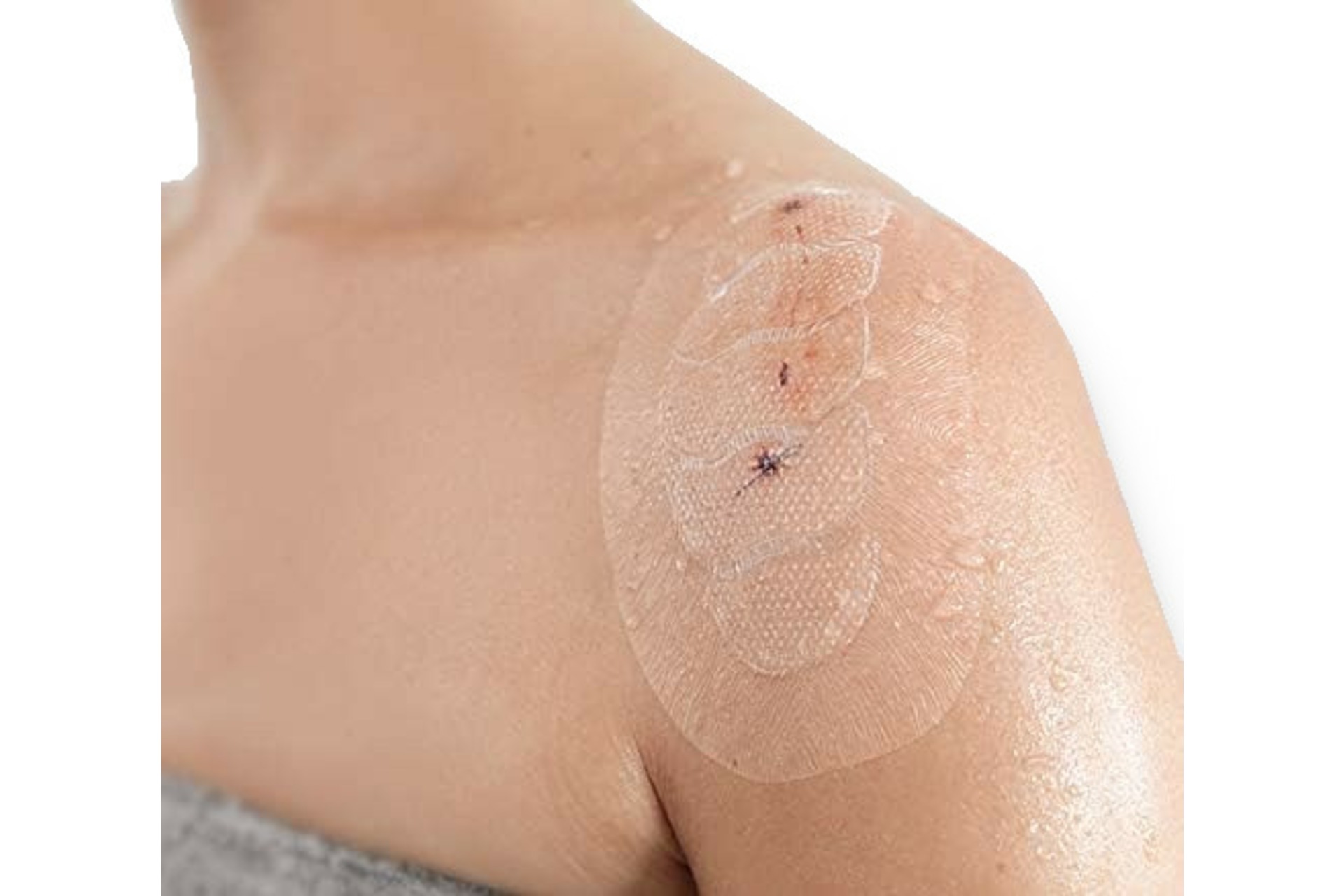 Leukomed® Control Wundverband steril