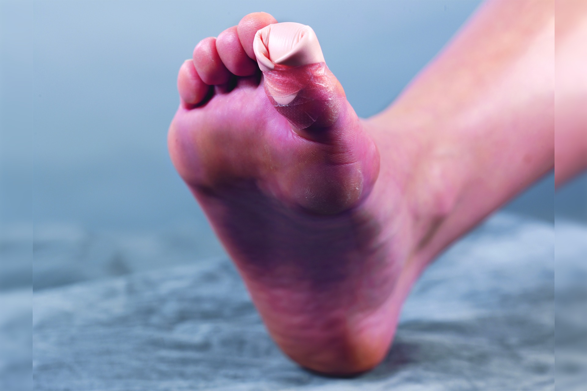 Allevyn Schaumverband haftend