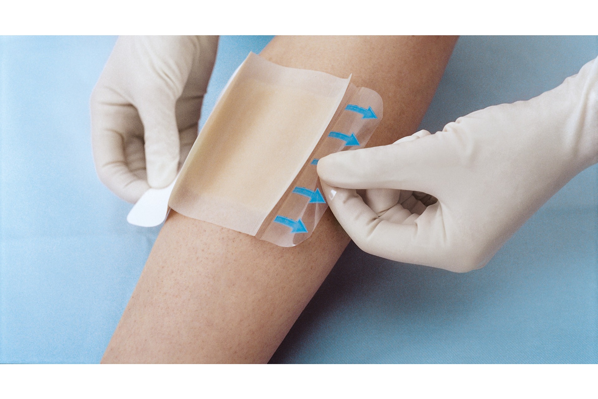 Hydrocoll Hydrokolloid - Verband