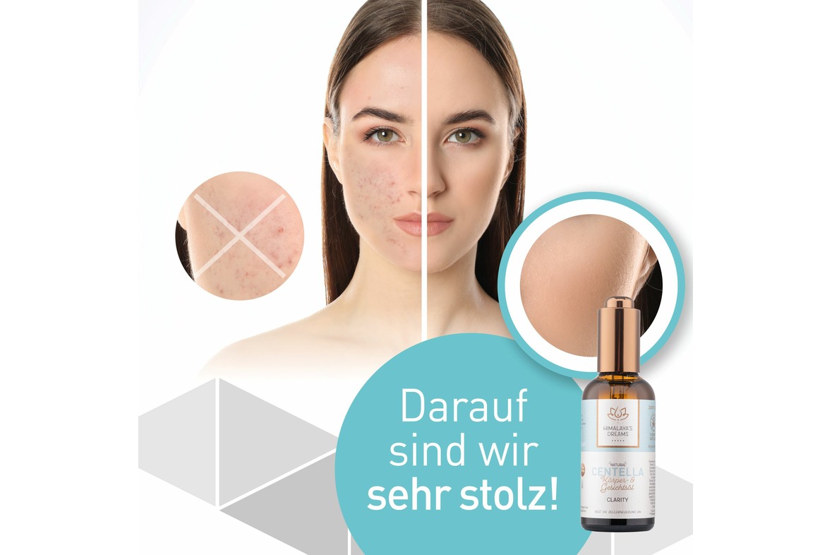 Ayurveda Körper- und Gesichtsöl Centella - Clarity